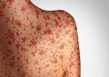 ମଙ୍ଗୋଲିଆରେ ବ୍ୟାପୁଛି ମିଳିମିଳା