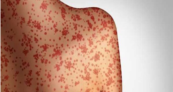 ମଙ୍ଗୋଲିଆରେ ବ୍ୟାପୁଛି ମିଳିମିଳା